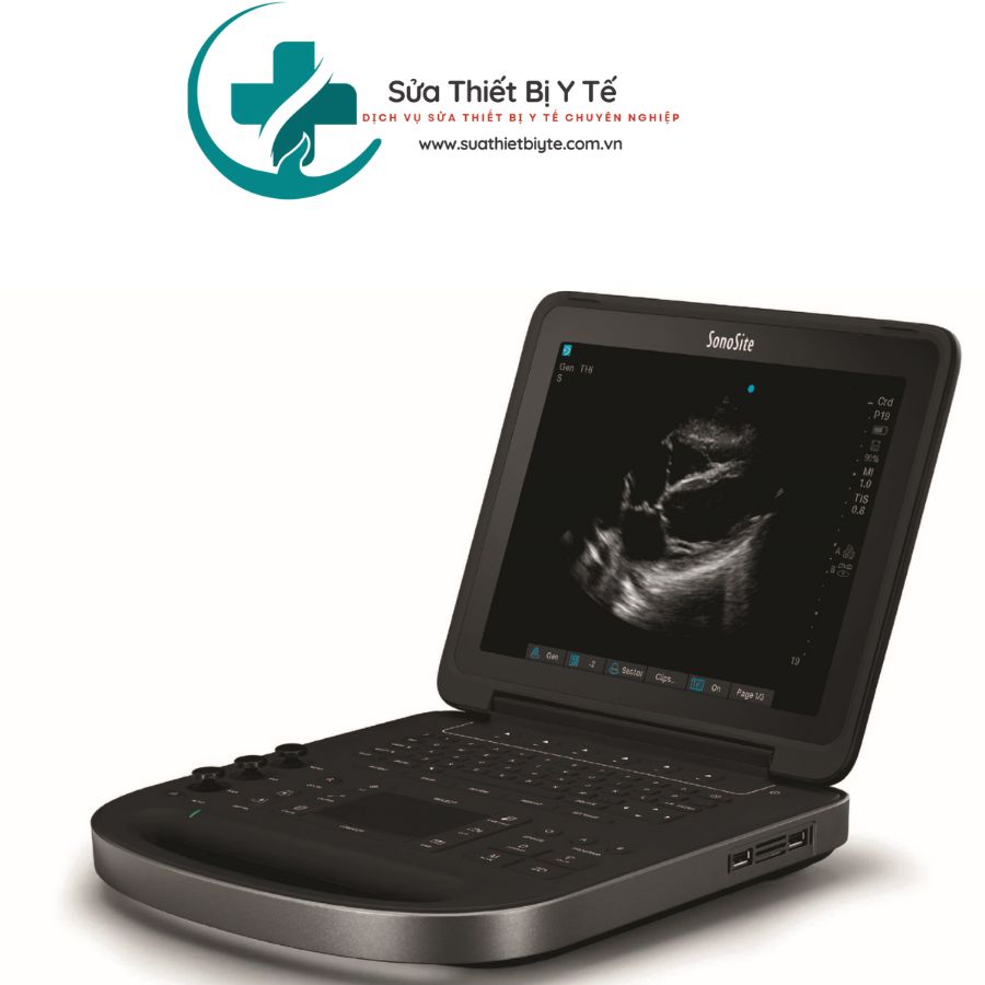 Sửa Chữa Máy Siêu Âm Xách Tay