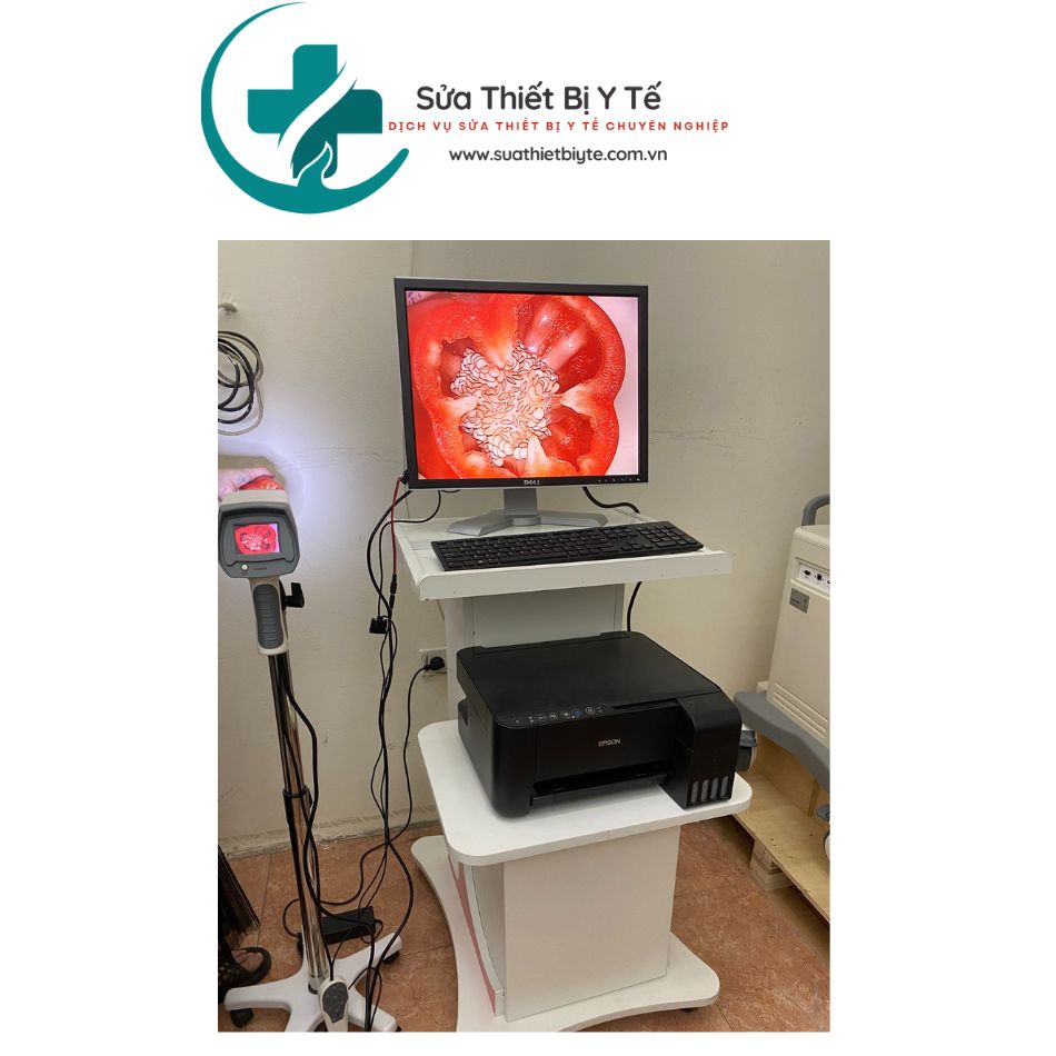 Sửa chữa máy soi cổ tử cung